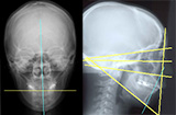 2．頭部X線規格写真